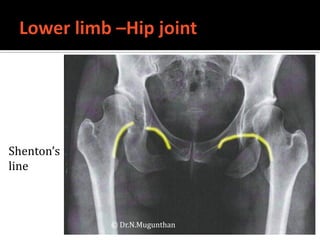 Shenton Line Radiology -Dr.N.Mugunthan | PDF