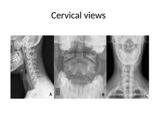 radiology 1.pptx cervical and lumbar x ray | PPTX