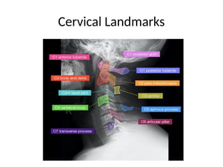 radiology 1.pptx cervical and lumbar x ray | PPTX