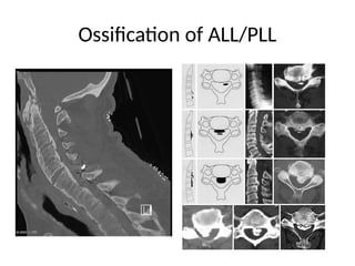 radiology 1.pptx cervical and lumbar x ray | PPTX