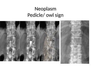 radiology 1.pptx cervical and lumbar x ray | PPTX
