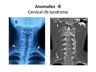 radiology intro xray spine cervical and lumbar | PPTX