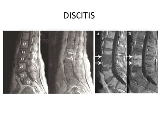 radiology MRI cervical and lumbar spine.pptx