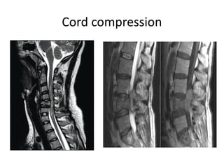 radiology MRI cervical and lumbar spine.pptx