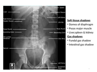 Radiology abd G2 this was done to just . | PPTX