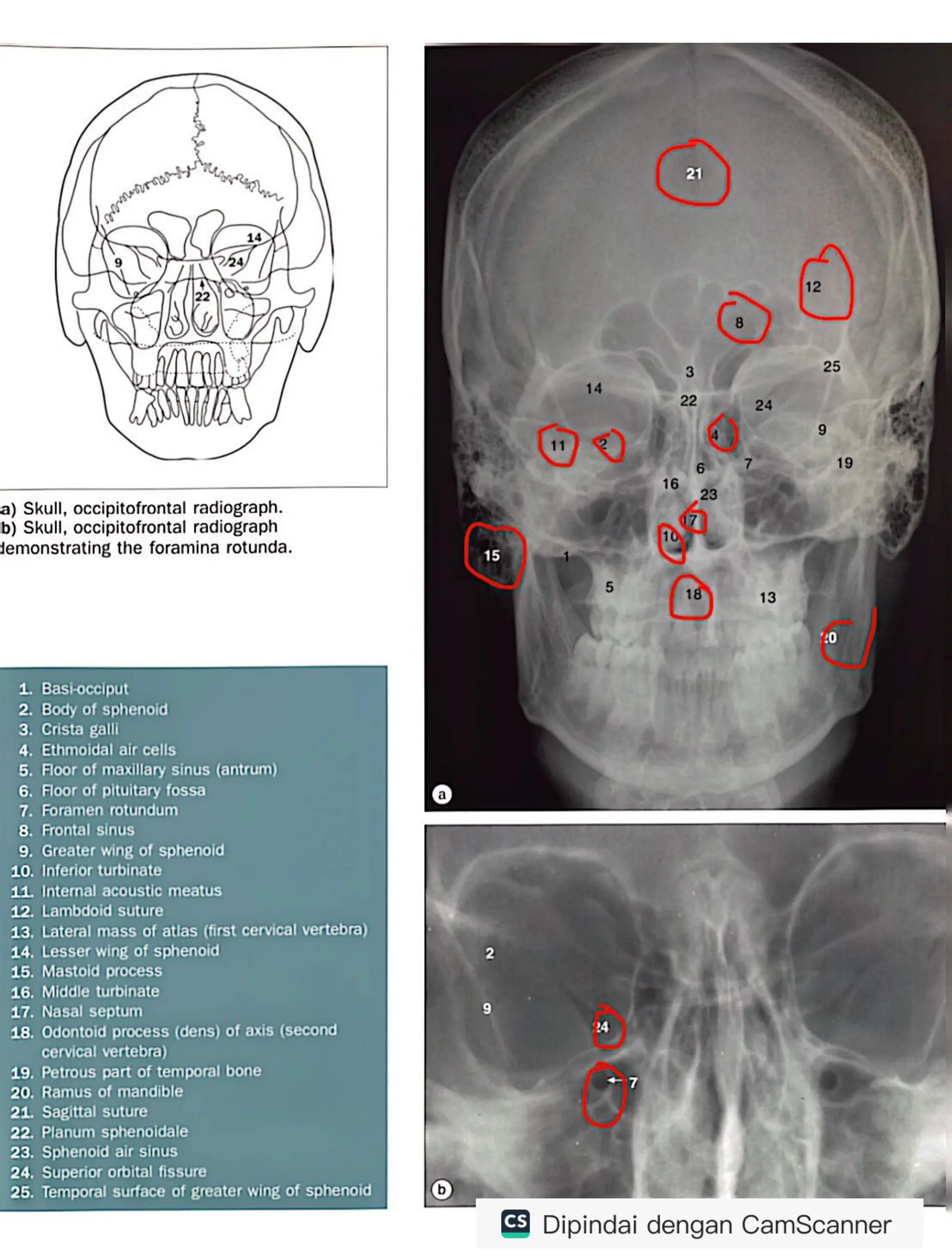 RADIOLOGY ANATOMY JUNIOR.pdf