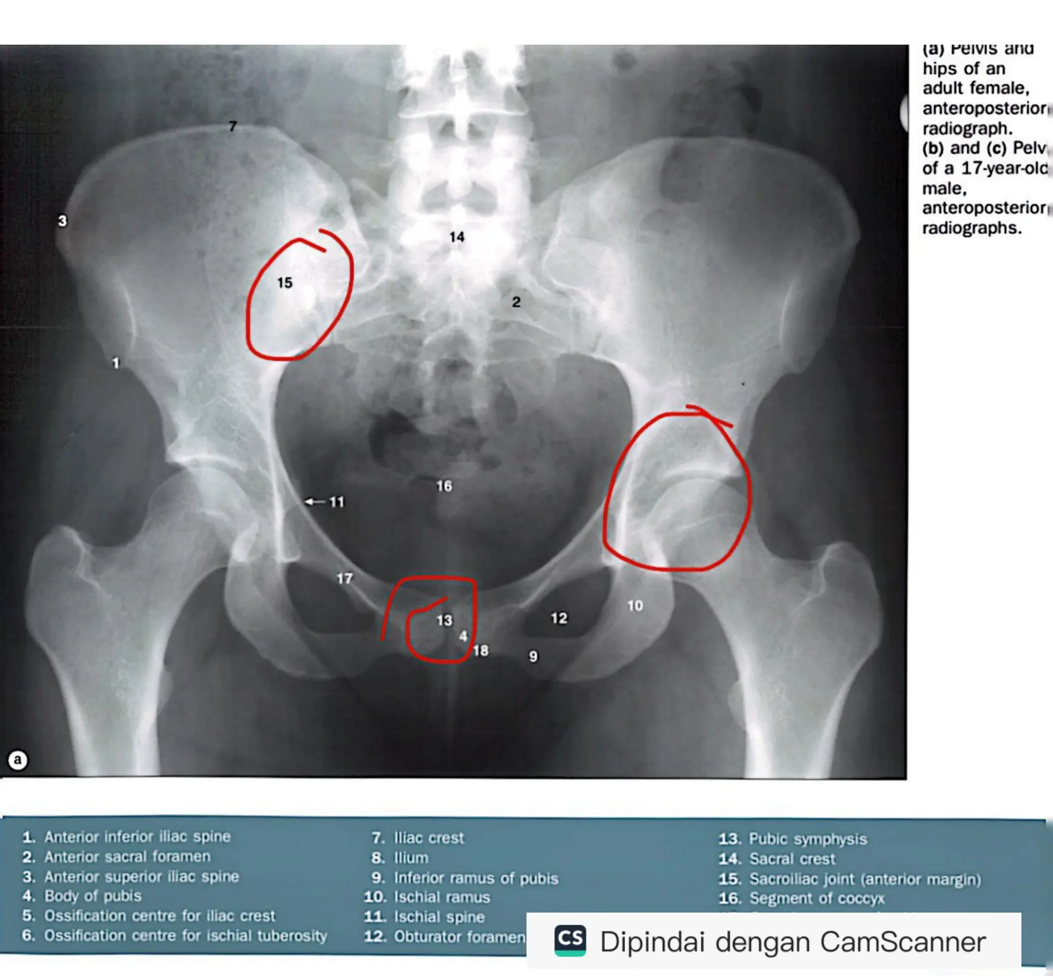 RADIOLOGY ANATOMY JUNIOR.pdf