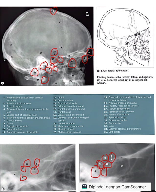 RADIOLOGY ANATOMY JUNIOR.pdf