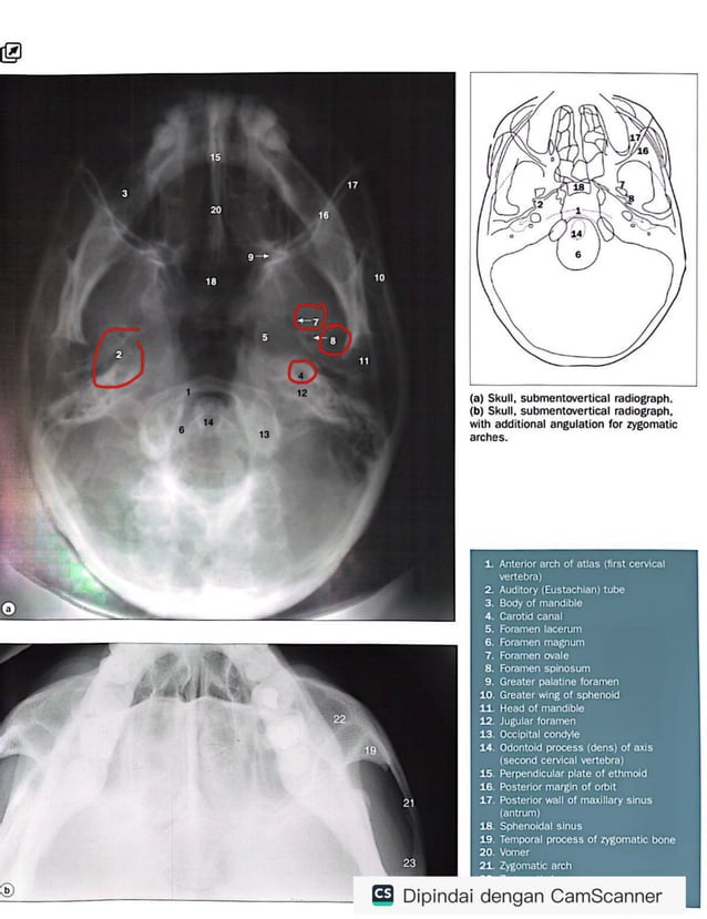 RADIOLOGY ANATOMY JUNIOR.pdf