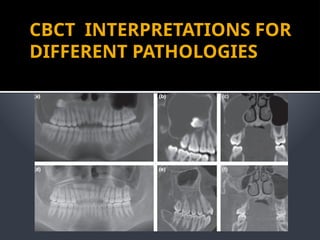 RADIOLOGY AND IMAGING OF ORAL PATHOLOGIES.pptx