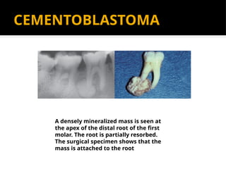 RADIOLOGY AND IMAGING OF ORAL PATHOLOGIES.pptx