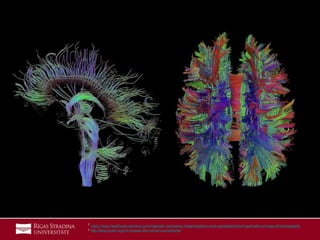 16
1 https://www.healthcare.siemens.com/magnetic-resonance-imaging/options-and-upgrades/clinical-applications/syngo-dti-tractography
2 http://blog.myesr.org/mri-reveals-the-human-connectome/
 