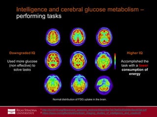 32
Intelligence and cerebral glucose metabolism –
performing tasks
Normal distribution of FDG uptake in the brain.
Higher IQ
Accomplished the
task with a lower
consumption of
energy
Downgraded IQ
Used more glucose
(non effective) to
solve tasks
1 http://bcr2016.org/files/event_sessions_lections/50eee4ee7dc7fe63c80a90bc9ecd03af.pdf
2 https://issuu.com/gfbertini/docs/brain_imaging_studies_of_intelligence_and_creativi/8
 