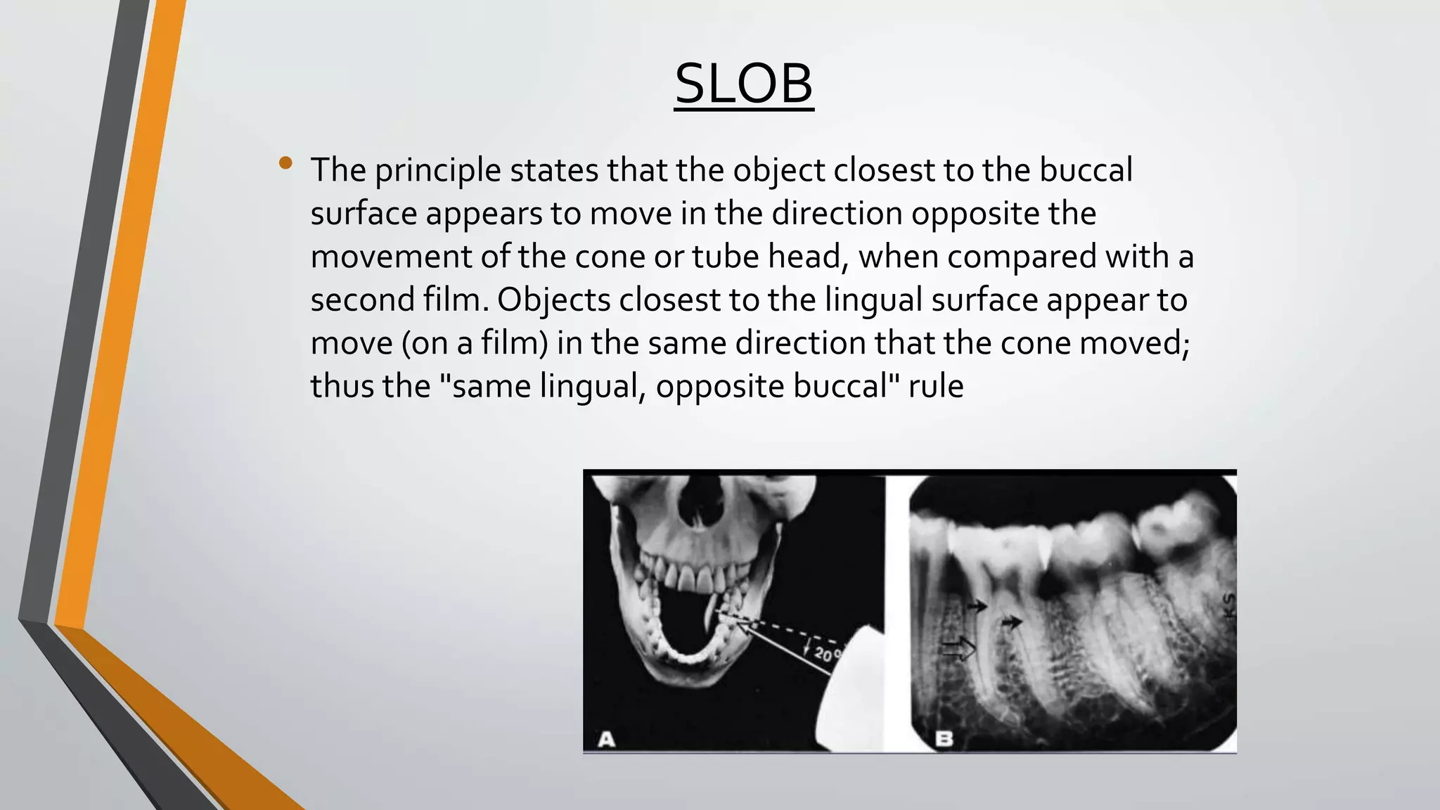 Radiology as applied to Pedodontics.pptx
