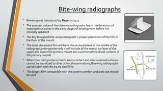 Radiology as applied to Pedodontics.pptx