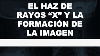 EL HAZ DE
RAYOS “X” Y LA
FORMACIÓN DE
LA IMAGEN
 
