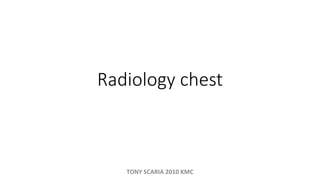 Radiology chest
TONY SCARIA 2010 KMC
 