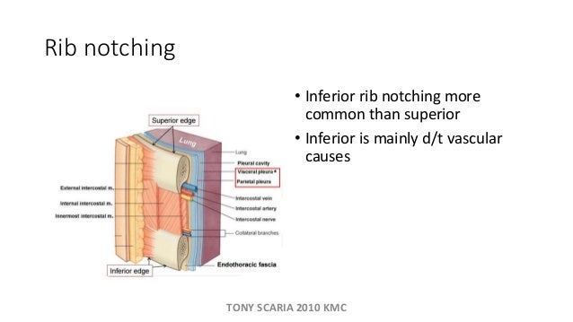 RESPIRATORY SYSTEM REVISION NOTES
