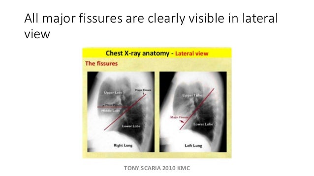 RESPIRATORY SYSTEM REVISION NOTES