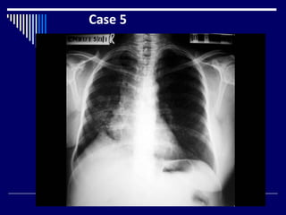 Case 5
 