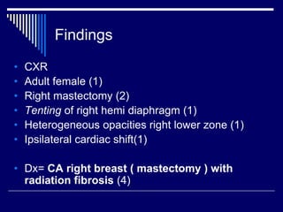 Findings
• CXR
• Adult female (1)
• Right mastectomy (2)
• Tenting of right hemi diaphragm (1)
• Heterogeneous opacities right lower zone (1)
• Ipsilateral cardiac shift(1)
• Dx= CA right breast ( mastectomy ) with
radiation fibrosis (4)
 