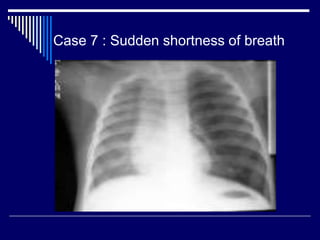 Case 7 : Sudden shortness of breath
 