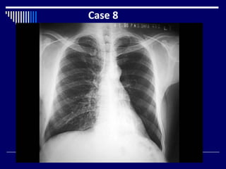 Case 8
 