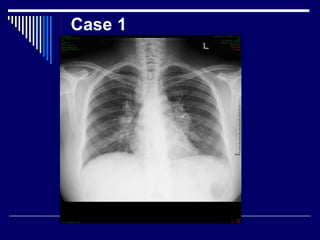 Case 1
 