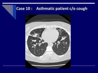 Case 10 : Asthmatic patient c/o cough
 