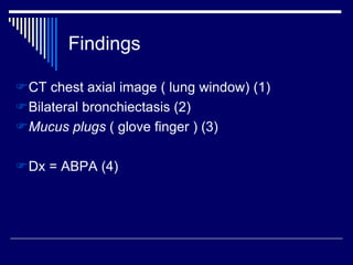 Findings
CT chest axial image ( lung window) (1)
Bilateral bronchiectasis (2)
Mucus plugs ( glove finger ) (3)
Dx = ABPA (4)
 