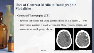 Uses of Contrast Media in Radiographic
Modalities
› Computed Tomography (CT):
– Specific indications for using contrast media in CT scans: CT with
intravenous contrast is used to visualize blood vessels, organs, and
certain tumors with greater clarity.
24-07-2023 RADIOLOGY CONTRAST MEDIA BY- DR. DHEERAJ KUMAR 33
 