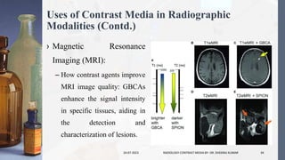 Uses of Contrast Media in Radiographic
Modalities (Contd.)
› Magnetic Resonance
Imaging (MRI):
– How contrast agents improve
MRI image quality: GBCAs
enhance the signal intensity
in specific tissues, aiding in
the detection and
characterization of lesions.
24-07-2023 RADIOLOGY CONTRAST MEDIA BY- DR. DHEERAJ KUMAR 34
 