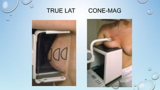 TRUE LAT CONE-MAG
31
 