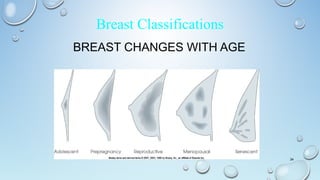 BREAST CHANGES WITH AGE
34
Breast Classifications
 