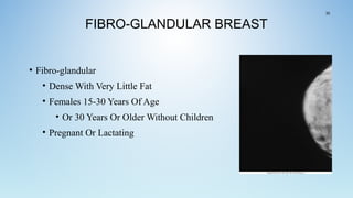 FIBRO-GLANDULAR BREAST
• Fibro-glandular
• Dense With Very Little Fat
• Females 15-30 Years Of Age
• Or 30 Years Or Older Without Children
• Pregnant Or Lactating
35
 