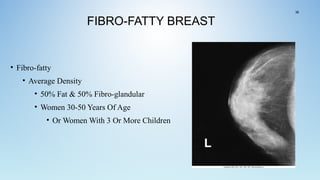 FIBRO-FATTY BREAST
• Fibro-fatty
• Average Density
• 50% Fat & 50% Fibro-glandular
• Women 30-50 Years Of Age
• Or Women With 3 Or More Children
36
 