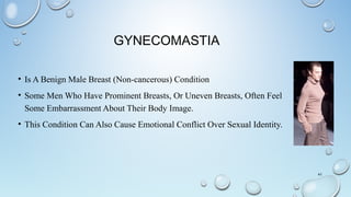 GYNECOMASTIA
• Is A Benign Male Breast (Non-cancerous) Condition
• Some Men Who Have Prominent Breasts, Or Uneven Breasts, Often Feel
Some Embarrassment About Their Body Image.
• This Condition Can Also Cause Emotional Conflict Over Sexual Identity.
41
 