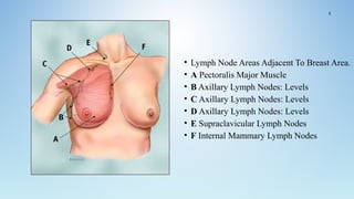 • Lymph Node Areas Adjacent To Breast Area.
• A Pectoralis Major Muscle
• B Axillary Lymph Nodes: Levels
• C Axillary Lymph Nodes: Levels
• D Axillary Lymph Nodes: Levels
• E Supraclavicular Lymph Nodes
• F Internal Mammary Lymph Nodes
5
 