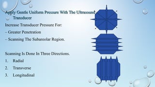 Apply Gentle Uniform Pressure With The UltrasoundApply Gentle Uniform Pressure With The Ultrasound
TransducerTransducer
Increase Transducer Pressure For:
– Greater Penetration
– Scanning The Subareolar Region.
Scanning Is Done In Three Directions.
1. Radial
2. Transverse
3. Longitudinal
 