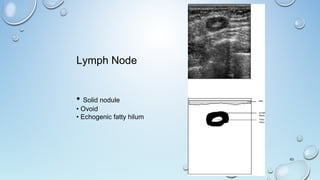 63
Lymph Node
• Solid nodule
• Ovoid
• Echogenic fatty hilum
 