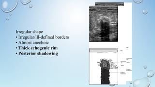 Irregular shape
• Irregular/ill-defined borders
• Almost anechoic
• Thick echogenic rim
• Posterior shadowing
 