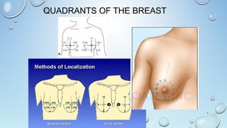 QUADRANTS OF THE BREAST
7
 