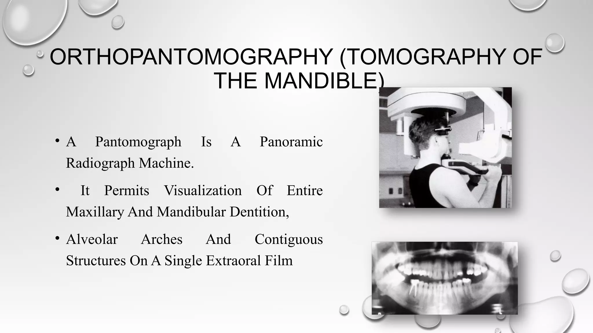 Radiological Imaging in Head and Neck and relevant anatomy | PPT