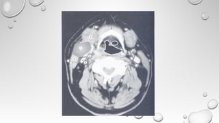 Radiological Imaging in Head and Neck and relevant anatomy | PPT