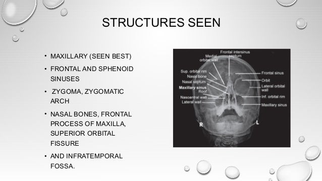 Radiological Imaging In Head And Neck And Relevant Anatomy Radiological Imaging In Head And Neck And Relevant Anatomy