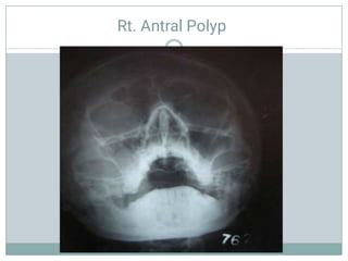 Radiology ENT.pdf