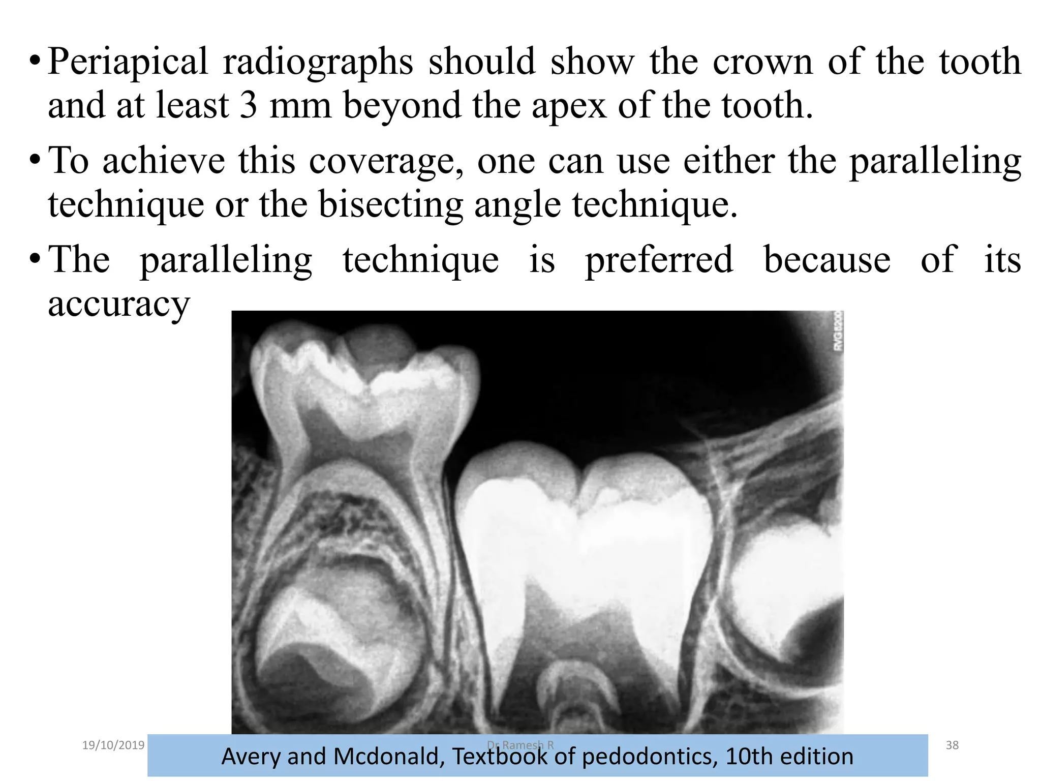 Radiograpgy in Pediatric Dentistry | PPT