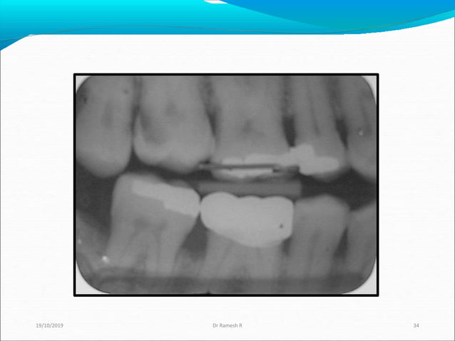 Radiograpgy in Pediatric Dentistry | PPT