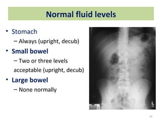 Normal Oil Level For Razz Radiology in newborn collected by Dr. Saiful islam MD | PPT