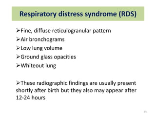 Air Bronchogram Rds common neonatal Radiology findings | PPT